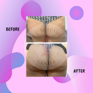 Untitled design (53)